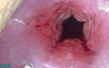 Japanese Beauty Undergoes Stunning Cervix Stretching and Uterus Dilation with Penetration - Unleash Your